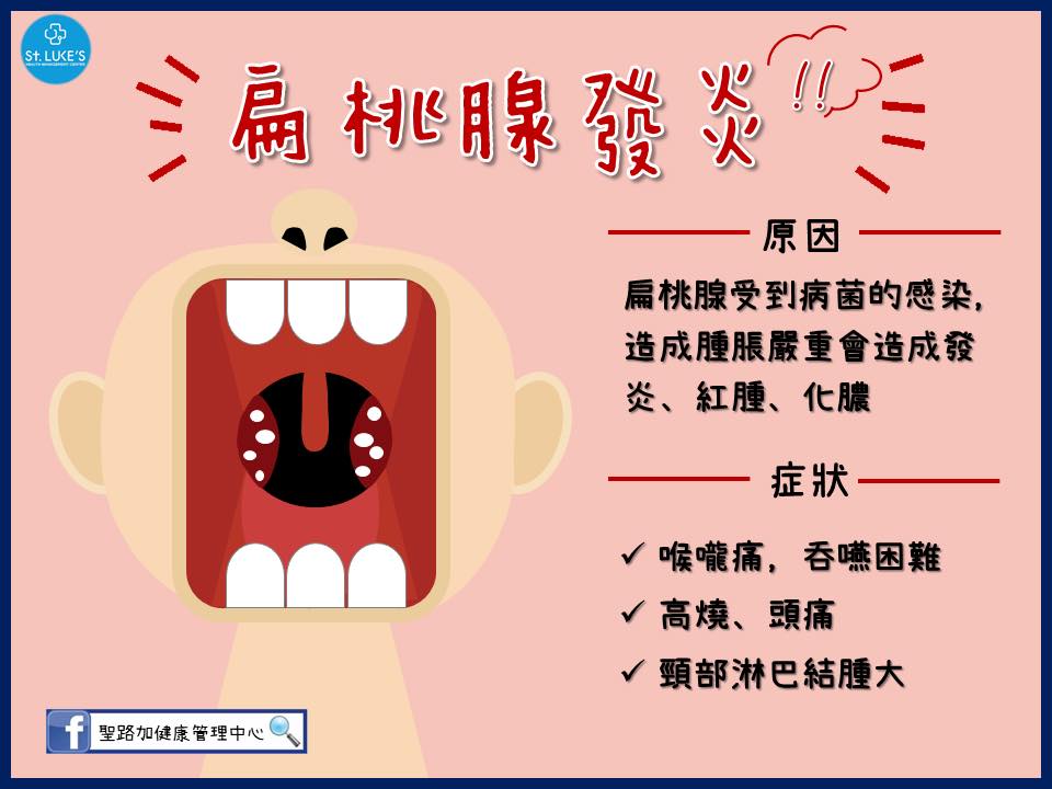 腺 炎 原因 急性 扁桃